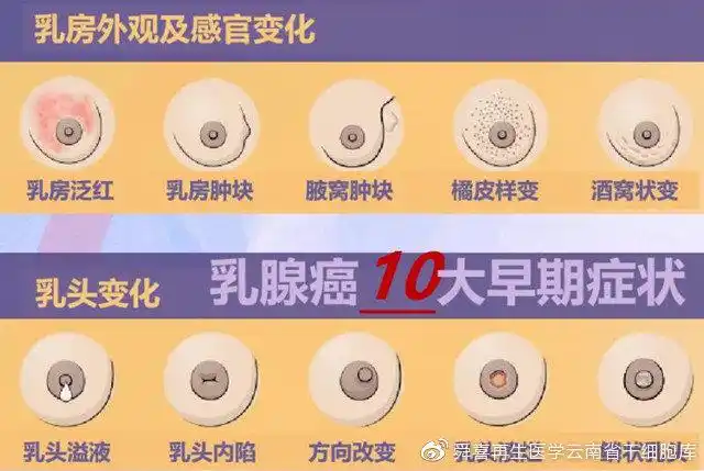 回缩,溃烂等)l 局部皮肤改变(橘皮样/酒窝样)l 腋窝淋巴结肿大乳腺癌