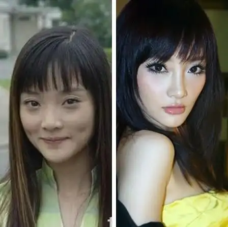 女星整容过度 盘点10大假面女郎