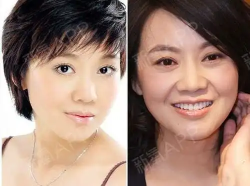 大家一看就知道,只是刘涛本人没有做出回应,不过双眼皮让刘涛更漂亮