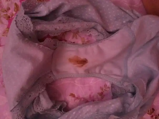 孕8周早上起来发现内裤上有血,什么情况?