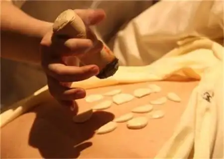 宫寒艾灸多久会有效果