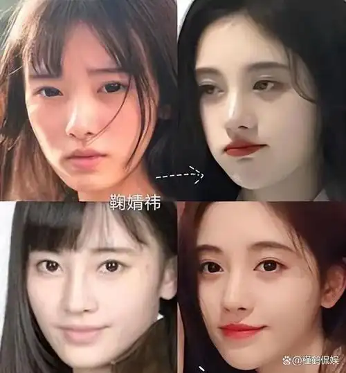 明星出道前对比照,有没有整容一目了然,网友:差距不是