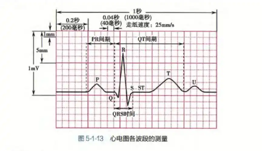 【基础复习】正常心电图波形特点和正常值之qrs波群(一)