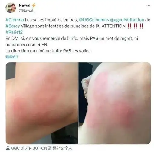 床虱危机席卷全球