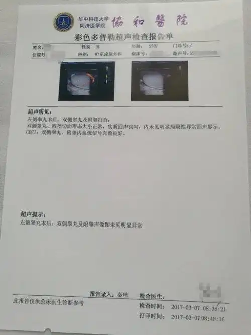 为什么这个小伙子阴囊肿胀并疼痛原来是急性睾丸扭转