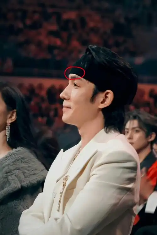 杨幂朱一龙 唇语##朱一龙受伤