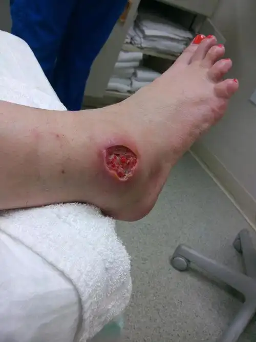 看到这种蜘蛛请拔腿狂奔太恐怖啦