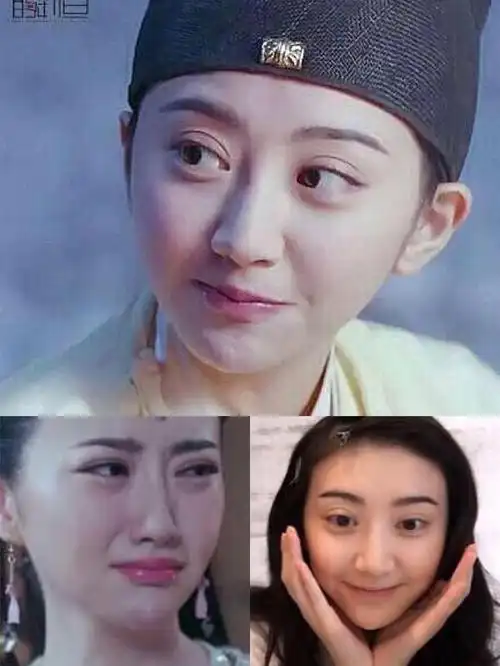 景甜亲身演绎:这年头割双眼皮得慎重,一个失败就是悲伤蛙了