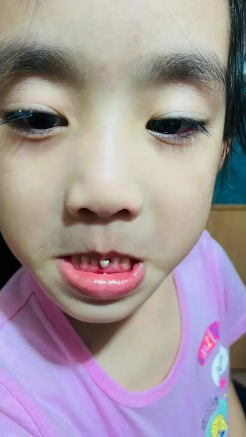 记录一下95今天是小妞5岁4个月零19天[呲牙]第