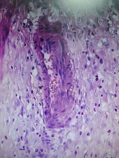 医学实验课Ⅰ病理学实验之肉芽组织