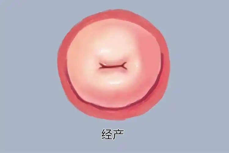 临床常见宫颈糜烂图片宫颈癌图像宫颈疾病示意图图片宫颈肥大图片宫颈