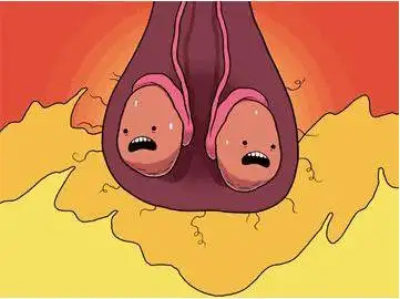 男性患阴囊炎的原因有:真菌感染,如念珠菌性阴囊炎,股癣累及阴囊,都会