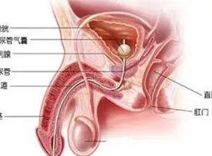 睾丸受浸润人体组织内浸入了异常细胞或出现了正常情况下不应出现的