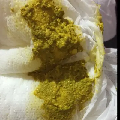 宝宝这几天就拉这样的便便,之前还是金黄的,有点稀,这几天给她吃了