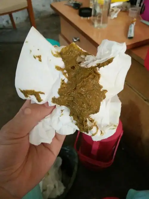 宝宝3个月奶粉喂养现在2天一次大便正常吗?是这个颜色的