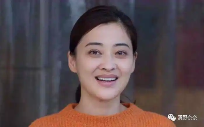 梅婷为什么总是黑眼圈大眼睛梅婷被黑眼圈黑惨了