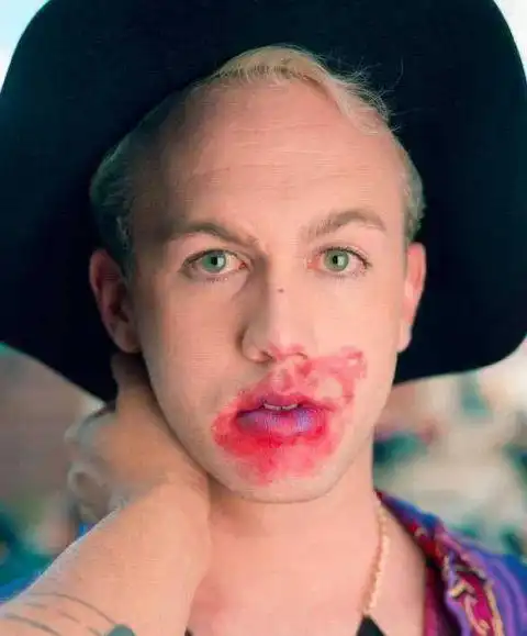 被陌生人猛亲留下口红印,有人享受有人吓懵