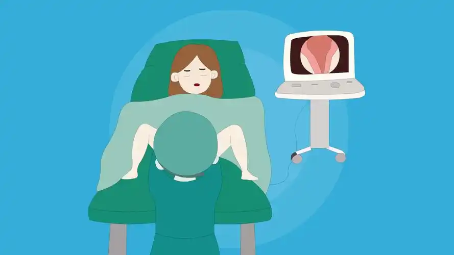 做宫腔镜检查需要住院吗