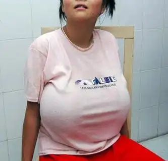 3年前,有阵子几乎天天吃木瓜炖雪蛤,胸部就从那时开始「第二次发育」