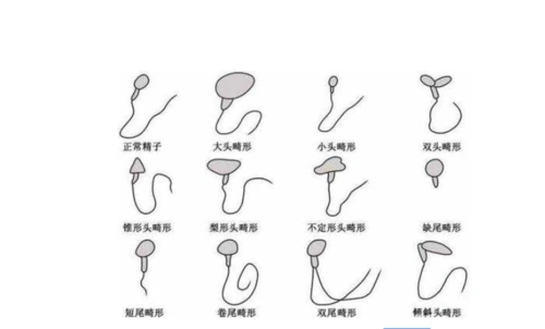 精子质量不佳会不会影响试管婴儿成功率小孩出生会不会有缺陷泰好国际