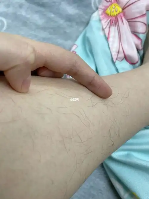 作为女生这腿毛是不是有点太长了