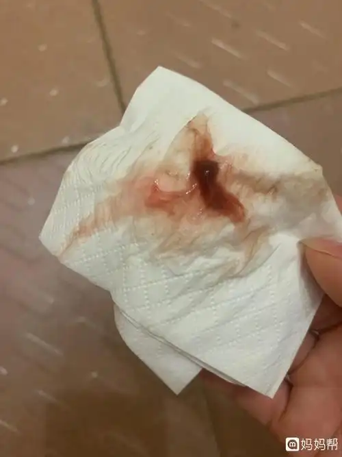 色鲜红,则应立刻就医移植术后711天 这个阶段可能是着床出血,在排卵与