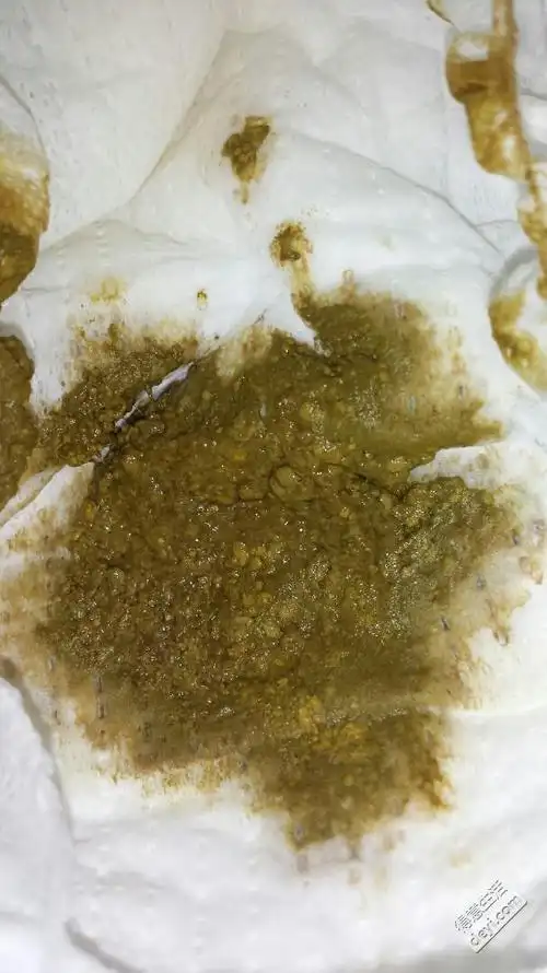 新生儿便便是什么样子,这样算是腹泻吗?