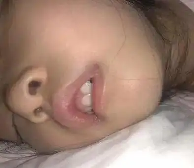 鼻塞的不良症状就会出现3不正确的睡眠姿势宝宝睡觉时,用嘴呼吸一般分