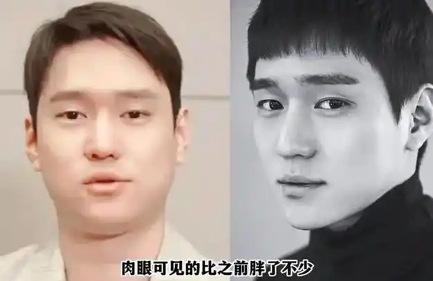 恋爱后李钟硕终于还是肿了酵母风对韩国男艺人一视同仁