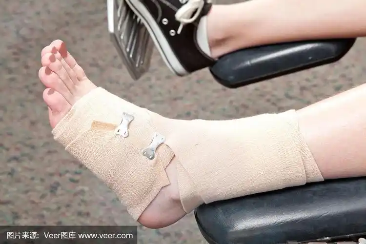 那女人扭伤的脚踝用绷带包扎.