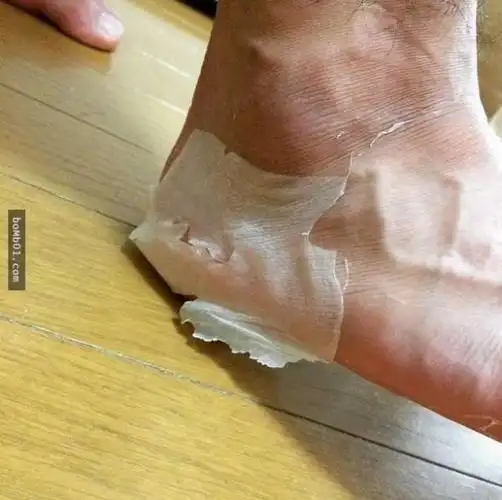 差1点就被恶到无法看下去的「宝贝脚蜕变」过程,坚