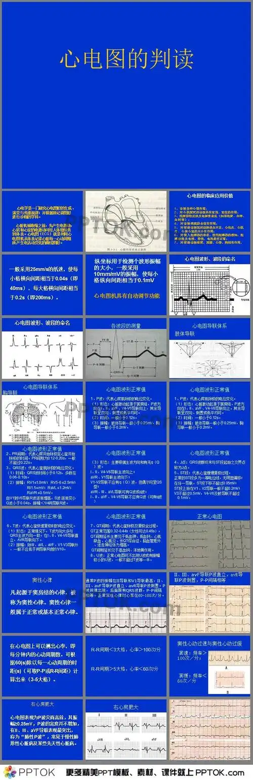 主要介绍了心电图的临床应用价值,心电图波形,波段的命名,各波段的