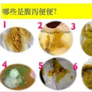 通过宝宝腹泻大便分辨腹泻原因从而对症治疗和护理