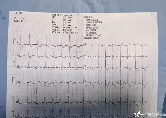 急诊室上性心动过速处理
