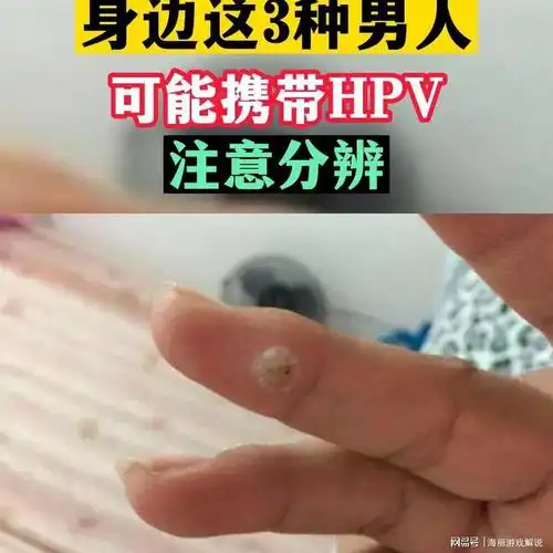 容易导致各种细菌病毒都会侵入其中,增加女性感染上hpv的几率