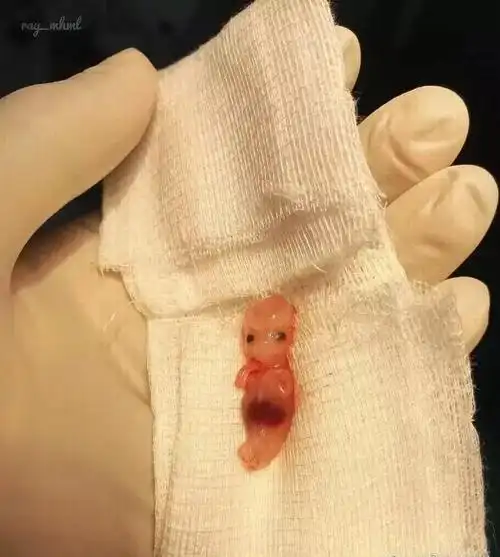 乐馨推荐:32岁赵丽颖产子:每一个孩子,都是妈妈从死神手中抢来的