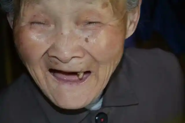 掉牙和寿命有关?过了60岁,牙齿剩多少颗算正常?看看你合格吗