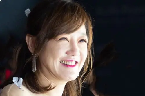 薛佳凝脸颊圆润发福明显,笑出一脸褶,网友:判若两人!