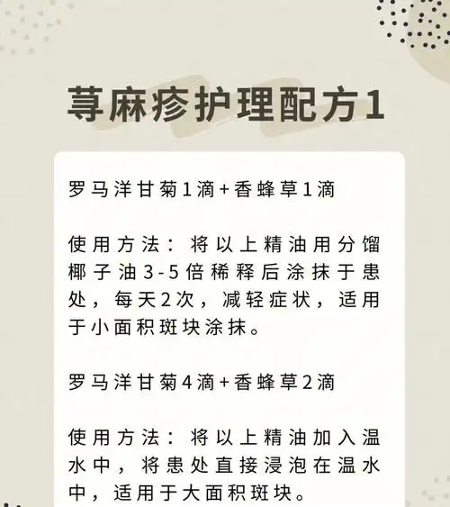 多特瑞配方荨麻疹用油