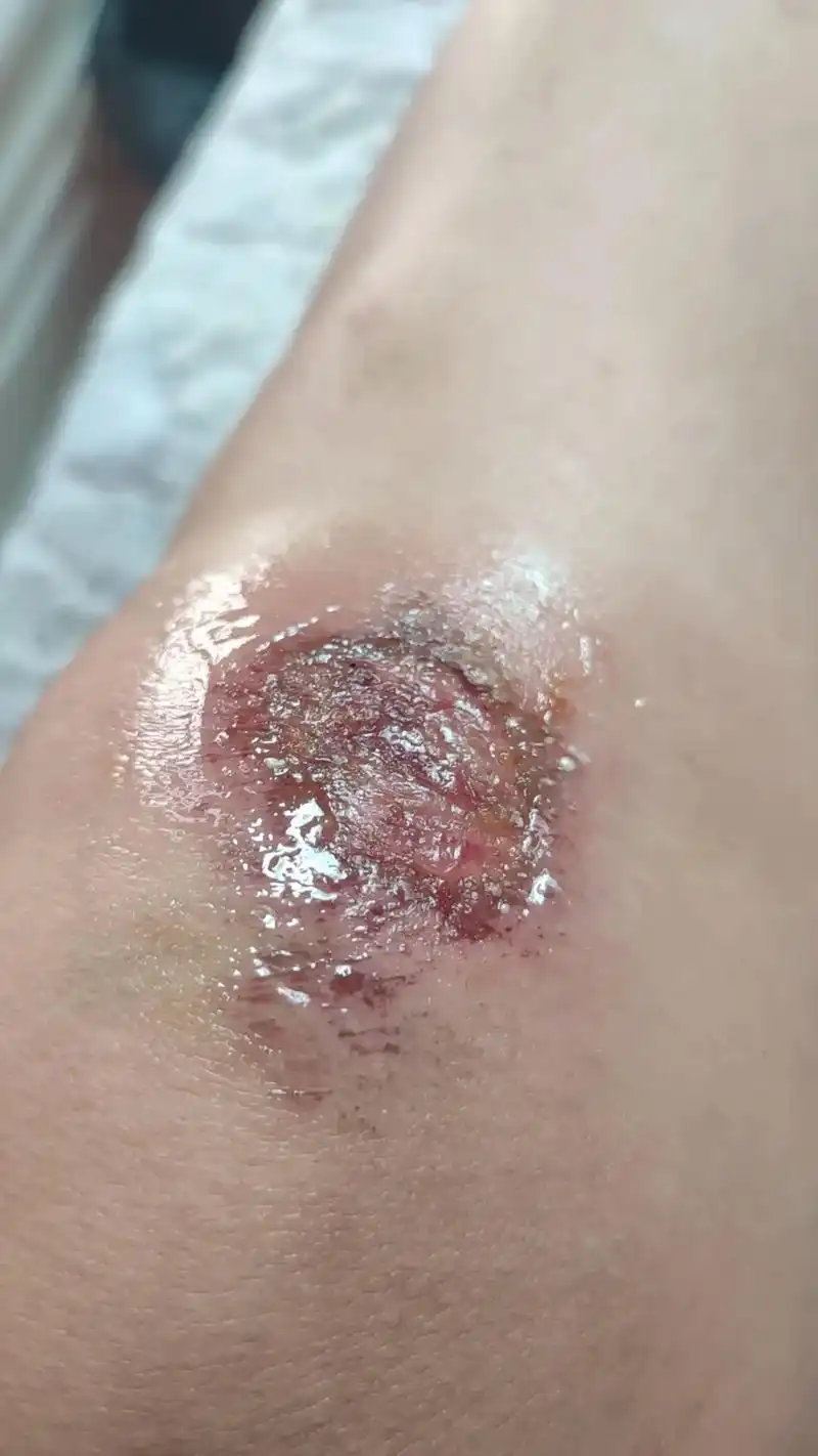 一不小心摔伤了腿,我没有责怪路不平,而是责怪自己不小心,看着 - 抖音