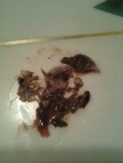 使用妇洁宝排出的废物图片和使用妇洁宝后一系列的解答