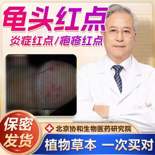 单盒装 【体验装】龟头炎红点红斑专用    送棉签