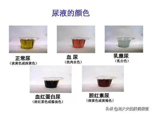 尿常规能查出什么病? - 石塘网