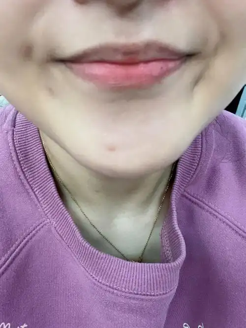 姐妹们告诉我这是不是梨涡