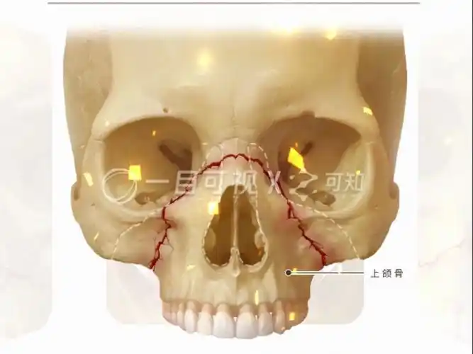 【医学生笔记】打人不打脸,来瞧瞧上颌骨骨折分级吧!