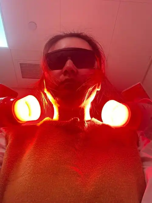 光动力对抗穿掘性毛囊炎