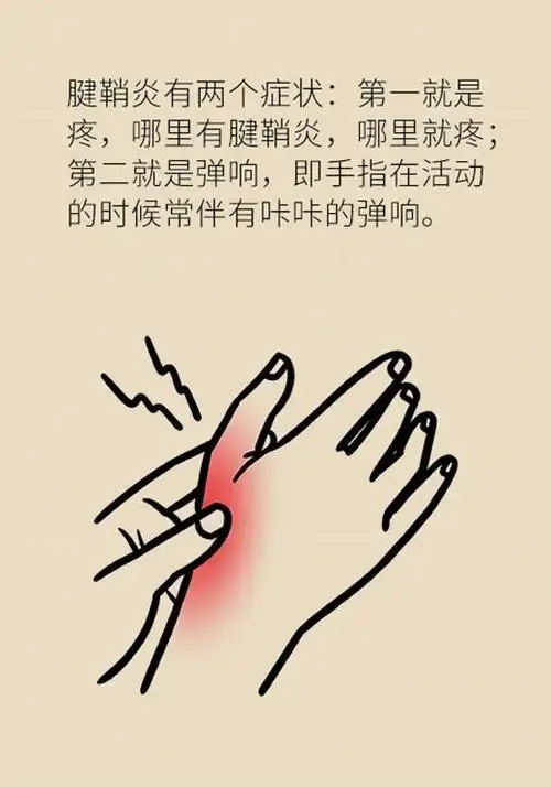 手上有包一按就疼手机玩多了都可能得这种病