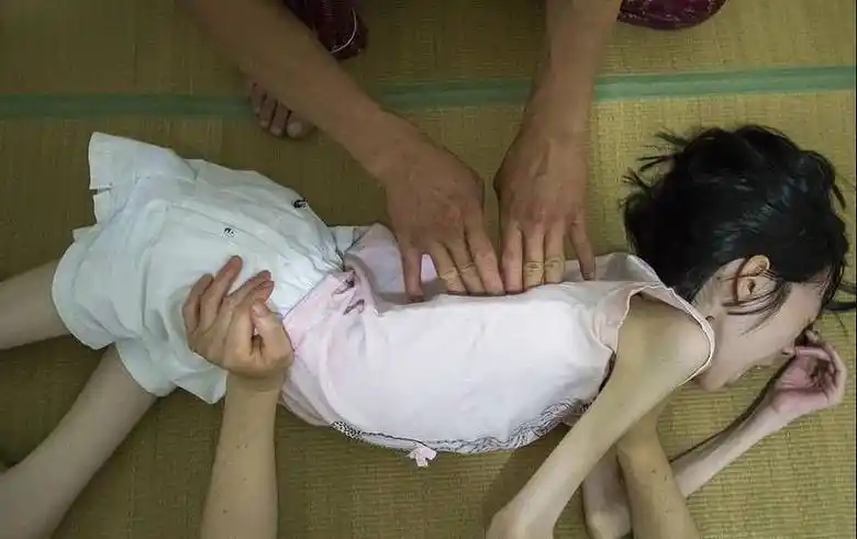 8岁女孩重10斤皮包骨头要饿死母亲却坚决不让她吃饭