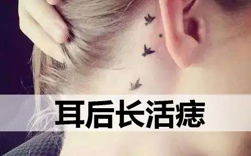 耳后长活痣的人会怎么样