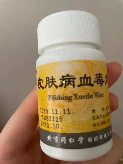 最近湿疹格外严重0101现在内服皮肤病血毒丸,外涂复方醋酸